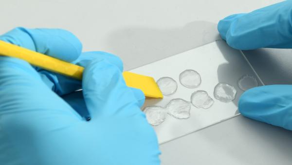 The new 3D skin model will allow scientists to simulate skin diseases and thus better understand them. Source: Empa