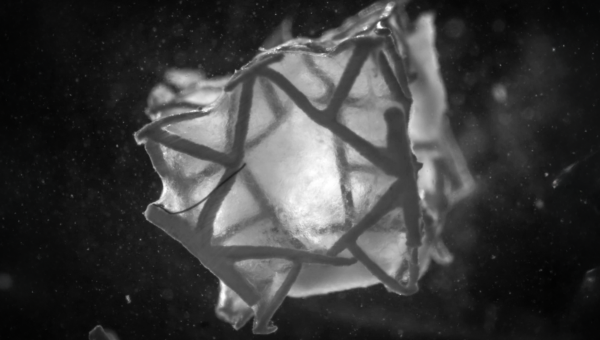 3D-printed cardiac patch engineered to match the mechanical properties of the heart (Image: Soft Robotics Laboratory / ETH Zurich)